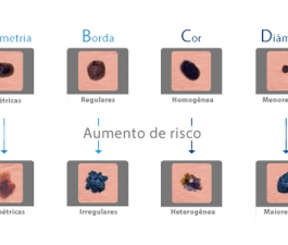 Maio é o mês de combate ao melanoma