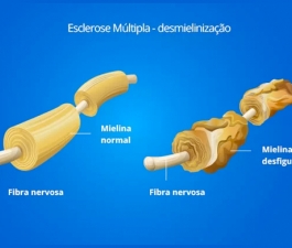 Dia Mundial da Esclerose Múltipla: Merck conduz pesquisa sobre expectativas de cuidadores dos pacientes