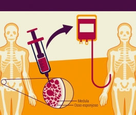 Mitos e verdades sobre o transplante de medula óssea