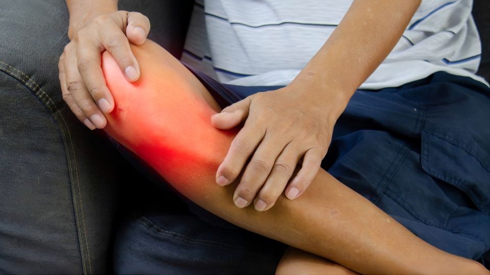 Além do cansaço muscular: quando a dor e o inchaço nos membros acendem o alerta para tumores ósseos